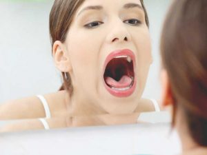 Những sai lầm khi lam sạch răng cần tránh 7