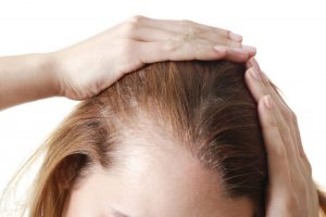 Mái tóc tiết lộ tình trạng nguy hiểm của sức khỏe 3