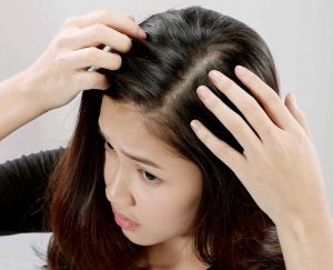 Mái tóc tiết lộ tình trạng nguy hiểm của sức khỏe 5